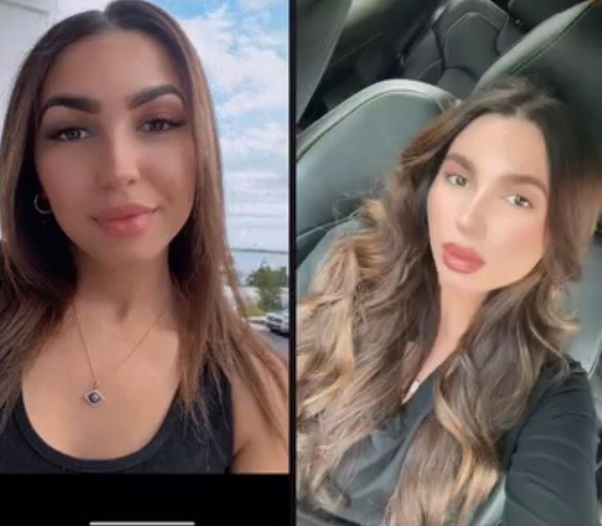 Oleuma™ TrichoGenesis Complex – Advanced Hair Revival Oil - Oleuma