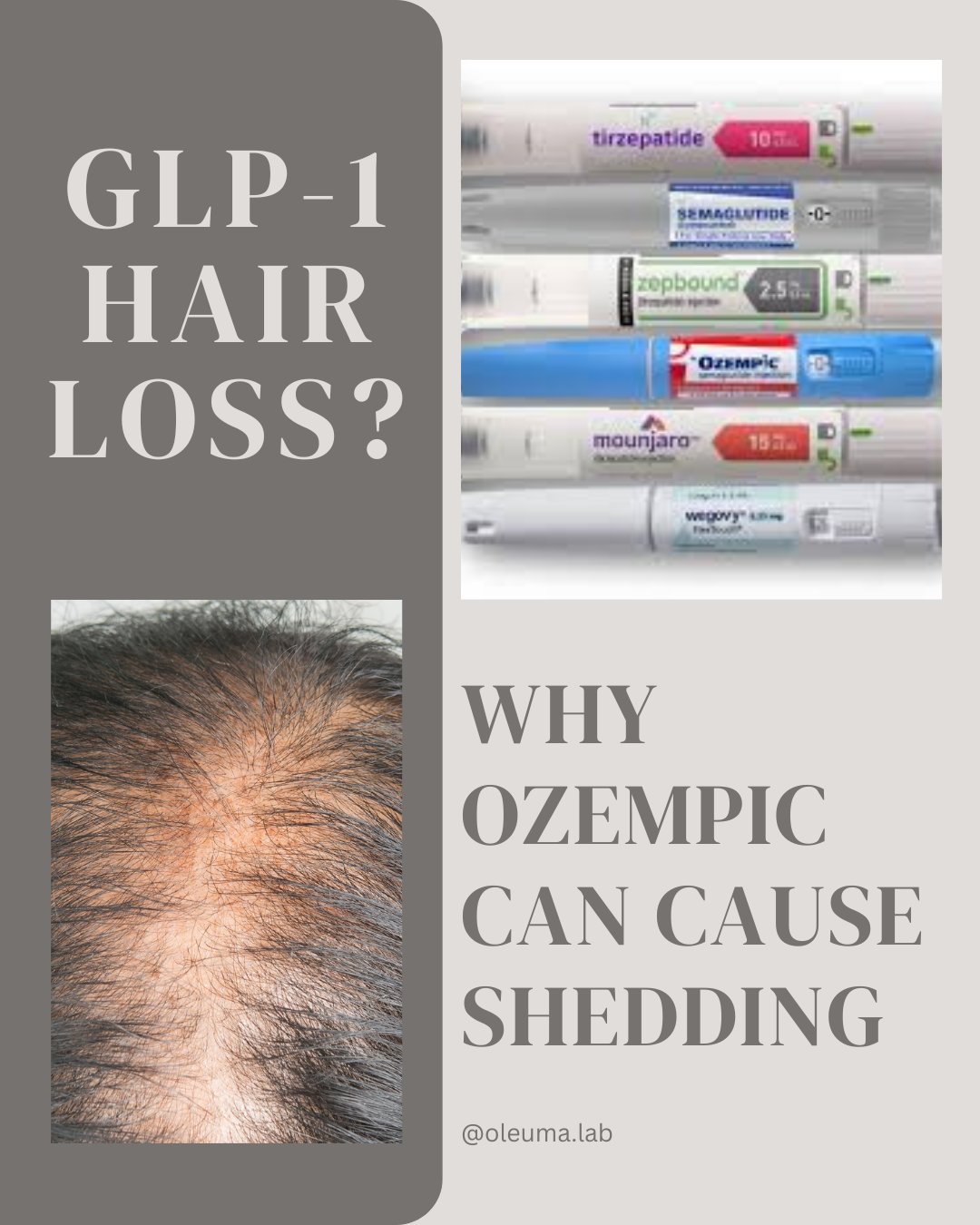 GLP-1 Hair Loss: Why Ozempic and Rapid Weight Loss Can Cause Shedding